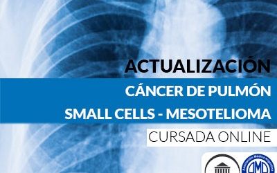 Cancer de pulmon small cells y mesotelioma
