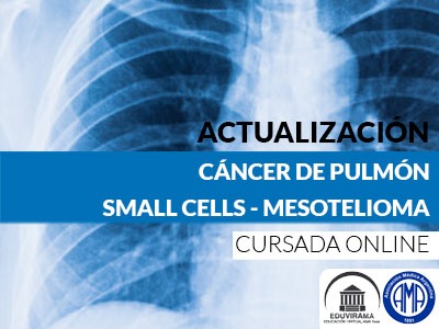 Cancer de pulmon small cells y mesotelioma