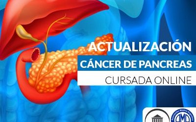 Avances en cáncer de páncreas