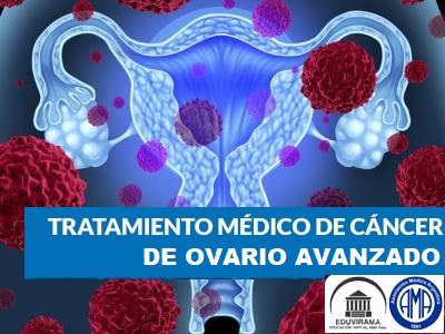 Tratamiento del cáncer de ovario avanzado